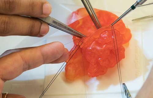L'anatomie digitale reproduite avec des matériaux d'impression 3D 