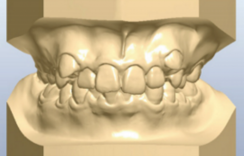 L’impression 3D permet à un laboratoire d'orthodontie de se développer 