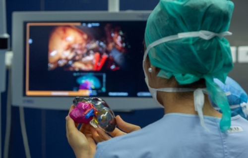 Le CHU de Bordeaux améliore la chirurgie du cancer du rein grâce aux technologies Stratasys 