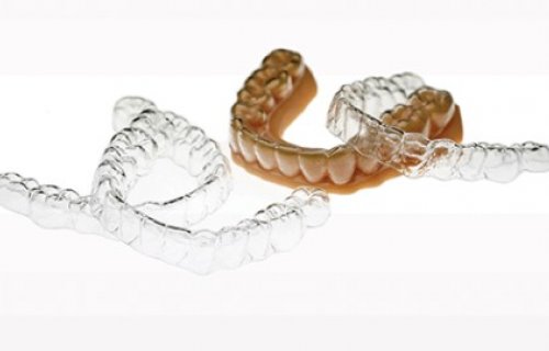 L'impression 3D révolutionne l'orthodontie numérique 