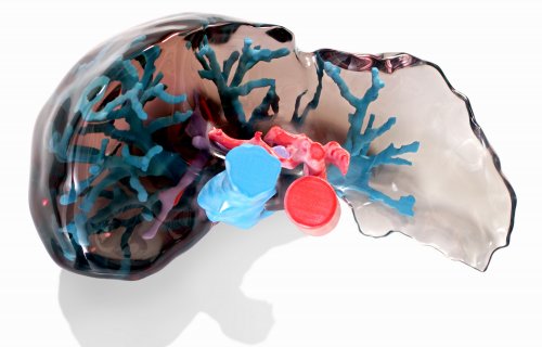 L'impression 3D améliore la planification pré-chirurgicale des greffes de foie par l'Université Dokuz Eylül 