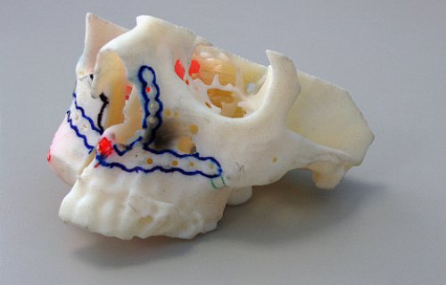 Un hôpital révolutionne la chirurgie réparatrice maxillo-faciale avec l’impression 3D 