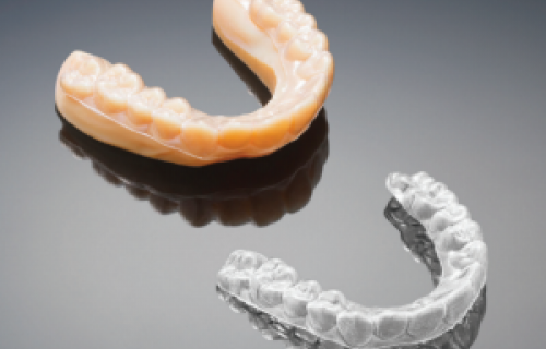 Les imprimantes 3D révolutionnent l’orthodontie 