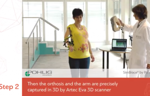 Vidéo - Scanner 3D Artec Eva - Othetics & Prosthetics 