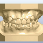 L’impression 3D permet à un laboratoire d'orthodontie de se développer 