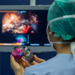 Le CHU de Bordeaux améliore la chirurgie du cancer du rein grâce aux technologies Stratasys 
