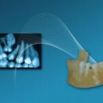 La dentisterie numérique se développe au profit des instituts dentaires 