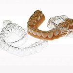 L'impression 3D révolutionne l'orthodontie numérique 