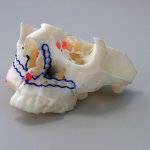 Un hôpital révolutionne la chirurgie réparatrice maxillo-faciale avec l’impression 3D 