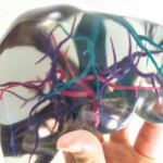 L’impression 3D couleur multi-matériaux permet la création de bio-modèles d'organes 