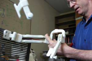 Un exosquelette imprimé en 3D pour une petite fille