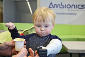 Ambionics réalise une prothèse enfantine unique via l'impression 3D