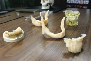 Moderniser un cabinet dentaire avec l'impression 3D