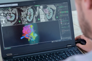 Le CHU de Bordeaux améliore la chirurgie du cancer du rein grâce aux technologies Stratasys