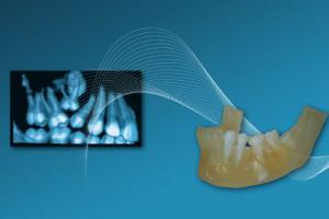 La dentisterie numérique se développe au profit des instituts dentaires