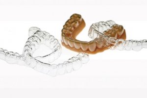 L'impression 3D révolutionne l'orthodontie numérique