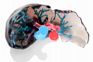 L'impression 3D améliore la planification pré-chirurgicale des greffes de foie par l'Université Dokuz Eylül