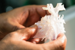 L'imprimante 3D aide un chirurgien à sauver des coeurs d'enfants