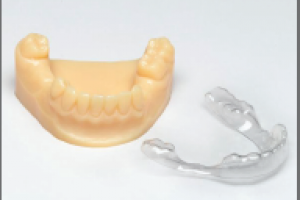 Des gouttières dentaires transparentes avec l’imprimante 3D Objet