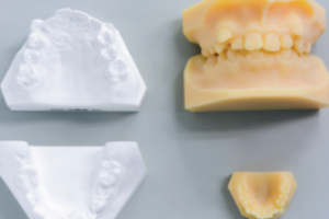 L’impression 3D permet à un laboratoire d'orthodontie de se développer