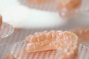 Les imprimantes 3D révolutionnent l’orthodontie