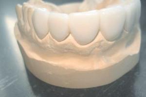 Remedent accroît ses activités de dentisterie cosmétique avec l’impression 3D