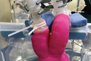 Centré sur le Coeur : 3D Print bureau créé des modèles cardiaques complexes