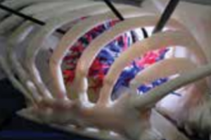 L’impression 3D couleur multi-matériaux permet la création de bio-modèles d'organes